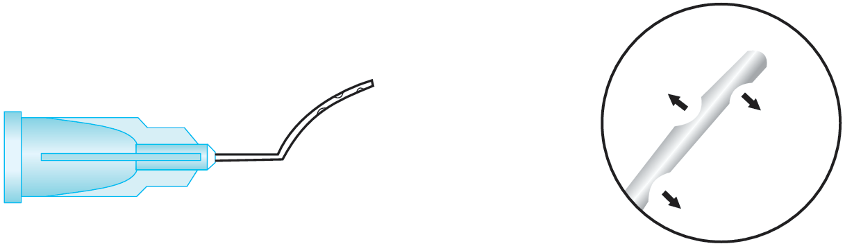 Lasik Irrigating Cannula (Buratto)